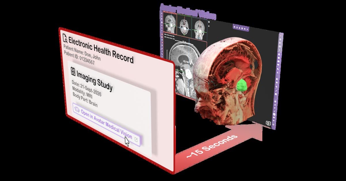 Avatar Medical integra imágenes 3D específicas del paciente con Epic EHR para agilizar las consultas clínicas