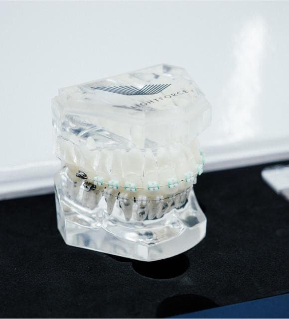 TG Orthodontics presenta los beneficios de los brackets Lightforce en Marlboro